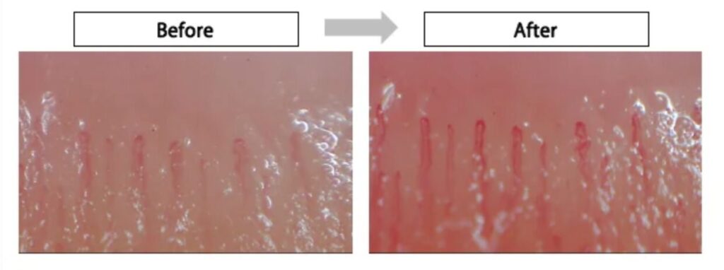 5分後の指先の血流の変化を表しています。